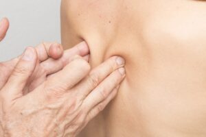 Physiotherapeuten wählen