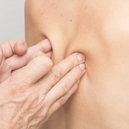 Physiotherapeuten wählen