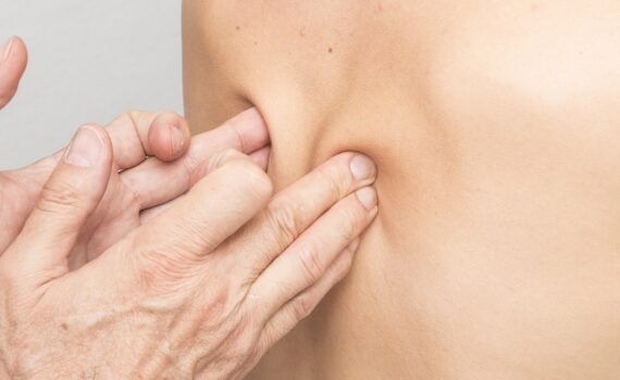Physiotherapeuten wählen